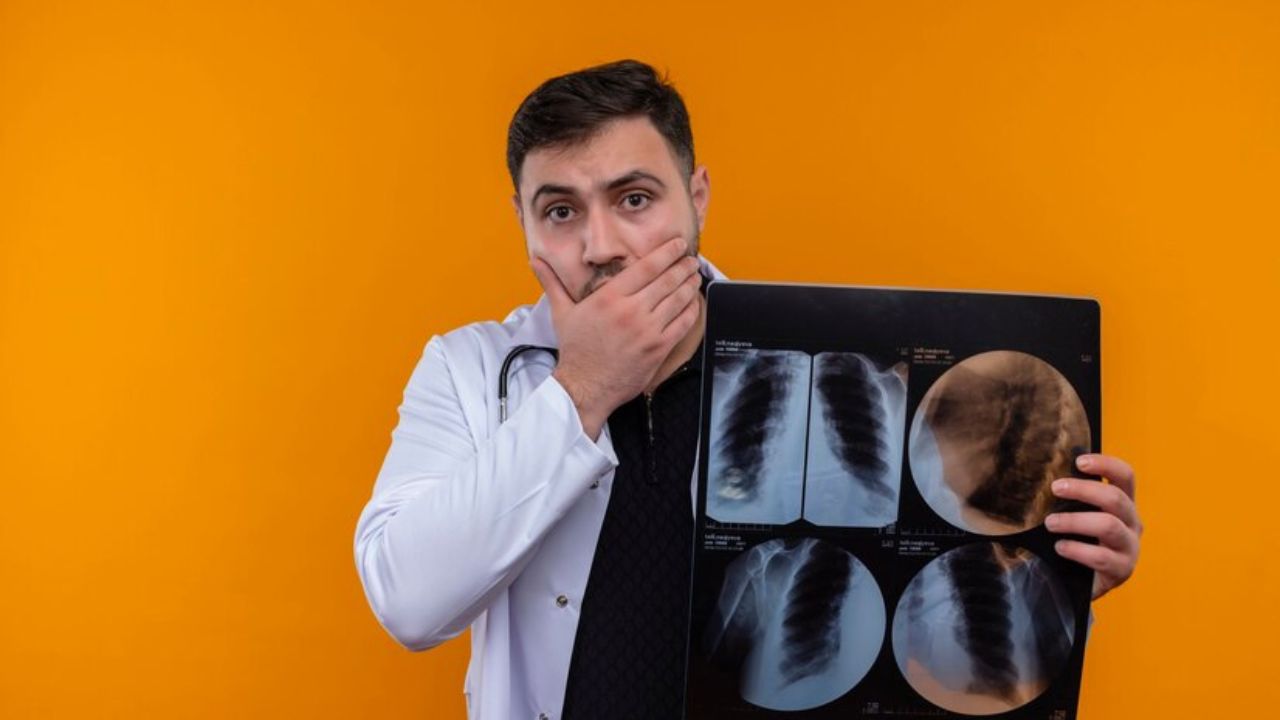 What is white lung pneumonia